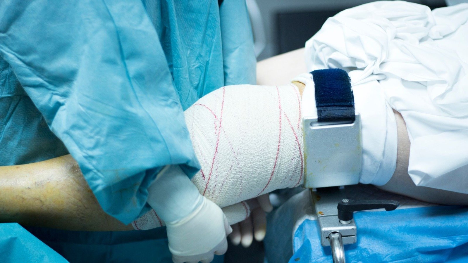 Everything You Need to Know About Orthopedic Surgery